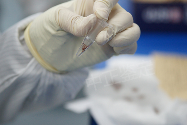 益阳亲子鉴定怎样预约,