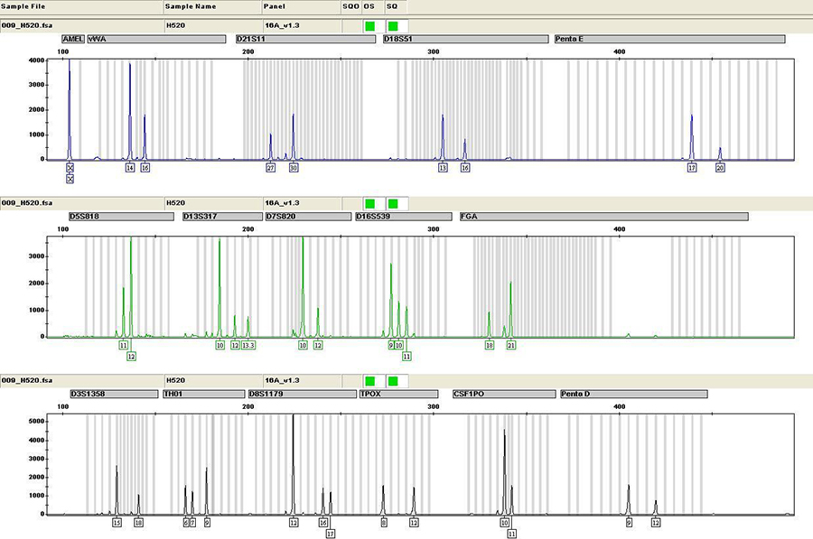 益阳匿名亲子鉴定中心到哪里, 益阳匿名亲子鉴定中心到哪里,